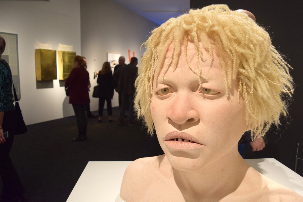 “African Teen With Albinism” by Tip Toland, stoneware clay, paint, chalk pastel, synthetic hair, 2013.